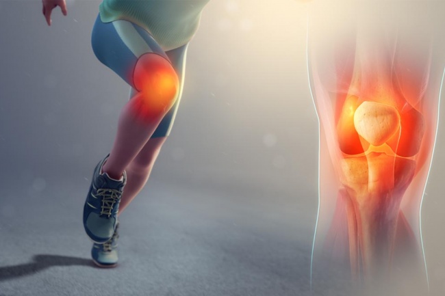 5 principais causas de dor no joelho e o que fazer